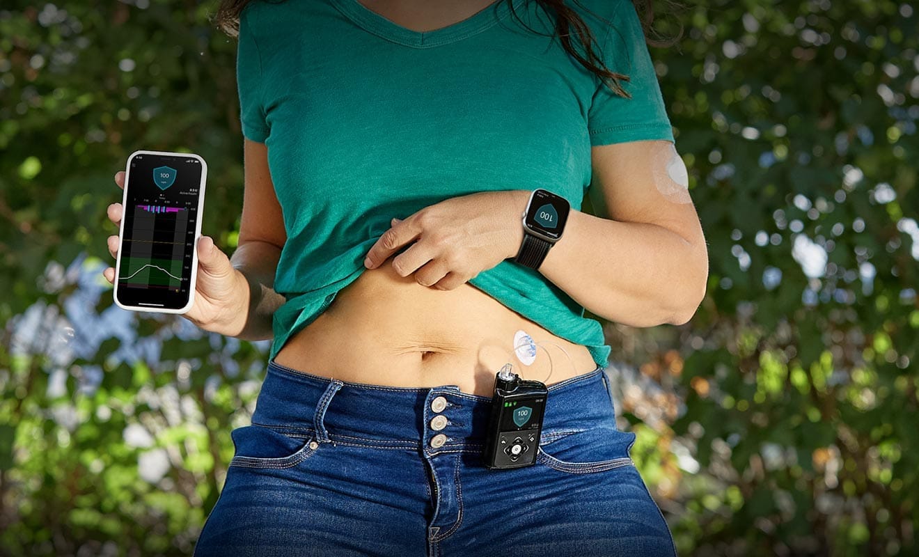 What is an Insulin Pump and How Does it Work?