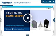 Changing Your Sensor | Medtronic Diabetes